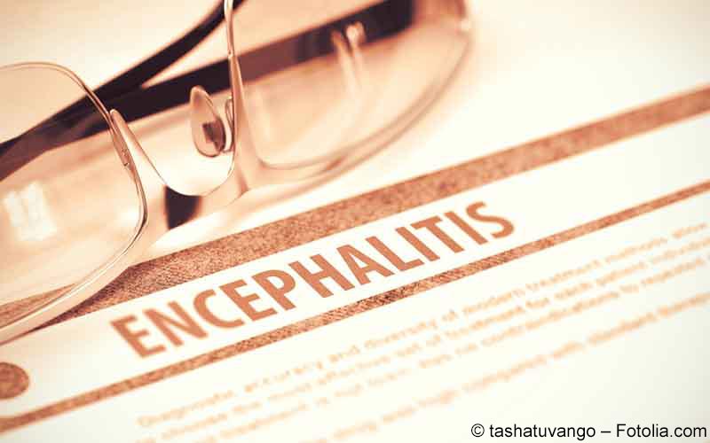 Encephalitis Encephalitis