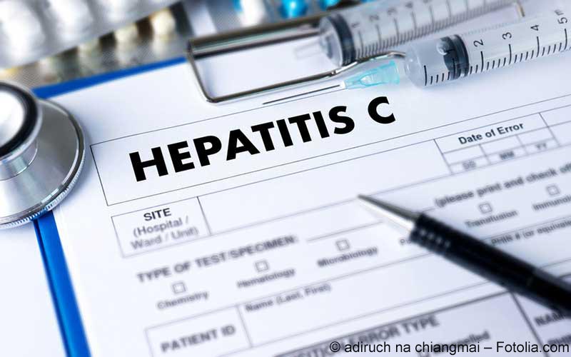 Hepatitis C Hepatitis C