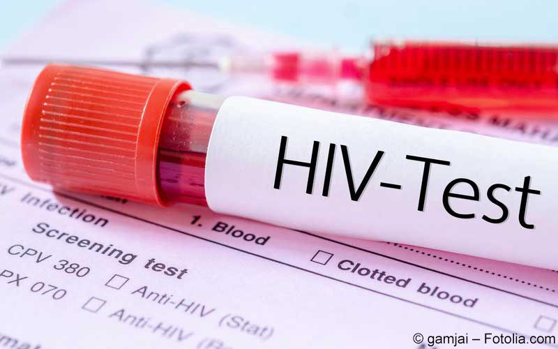 HIV Test HIV Test